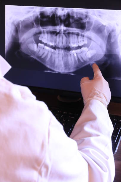 Best Emergency Tooth Extraction in Perry Park, CO